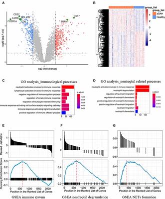 Identification of the key immune-related genes in aneurysmal subarachnoid hemorrhage